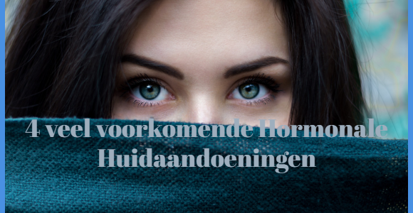 hormonale huidaandoeningen